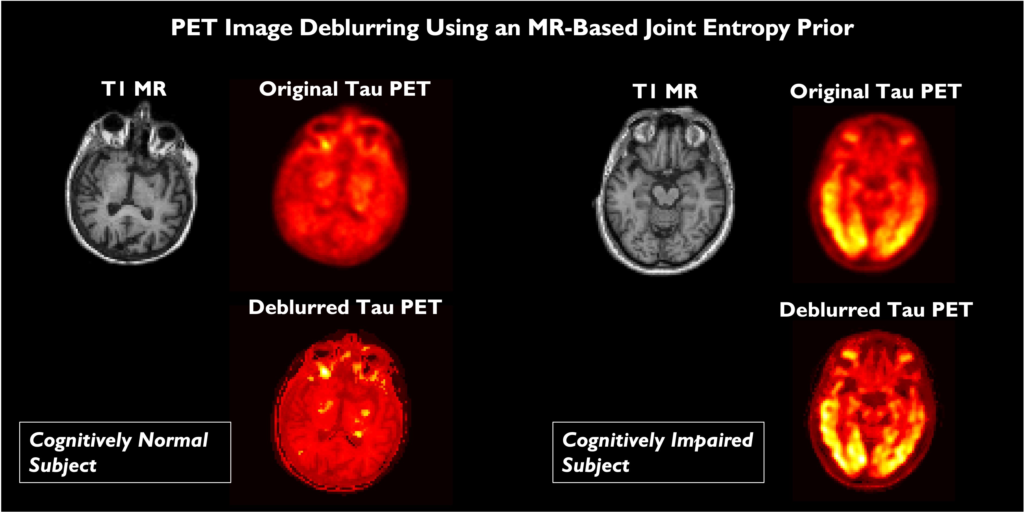 PET Image Deblurring