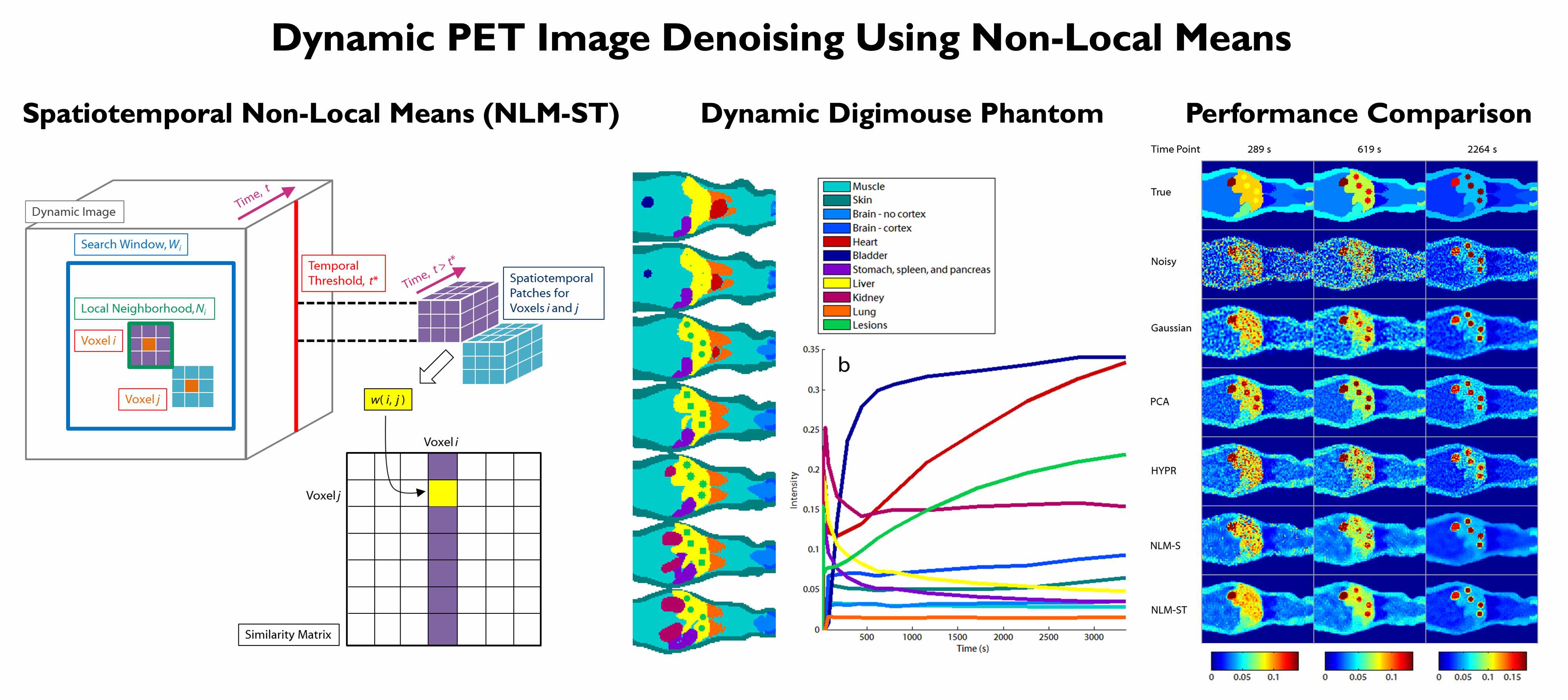 Anatomically Guided Dynamic PET Image Denoising