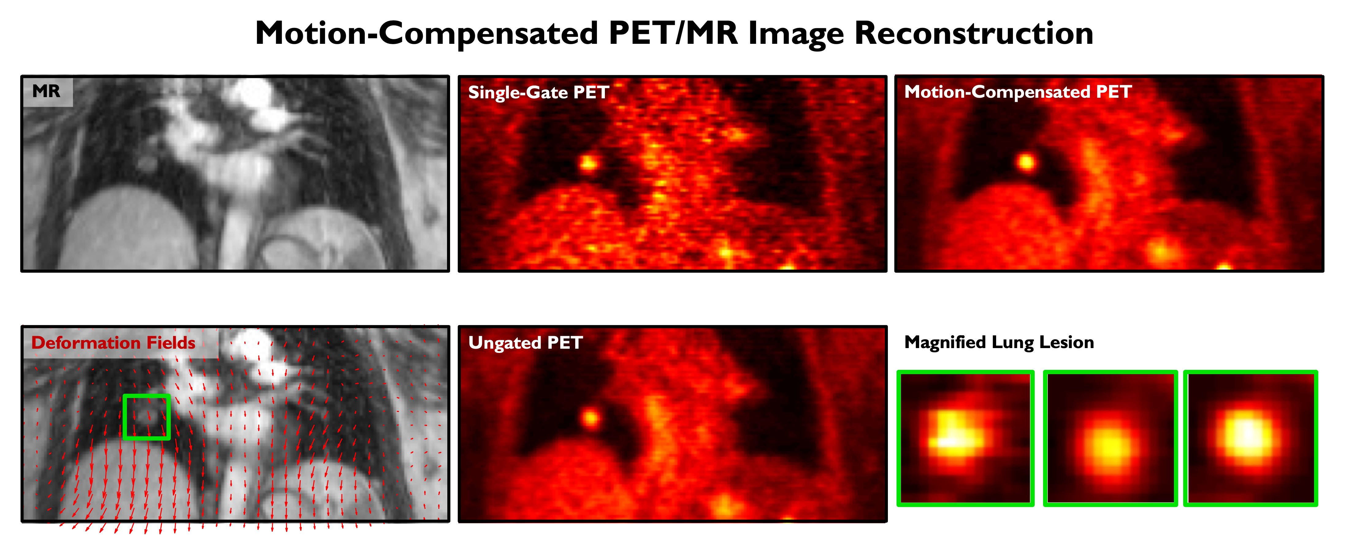 Motion Compensated Image Reconstruction